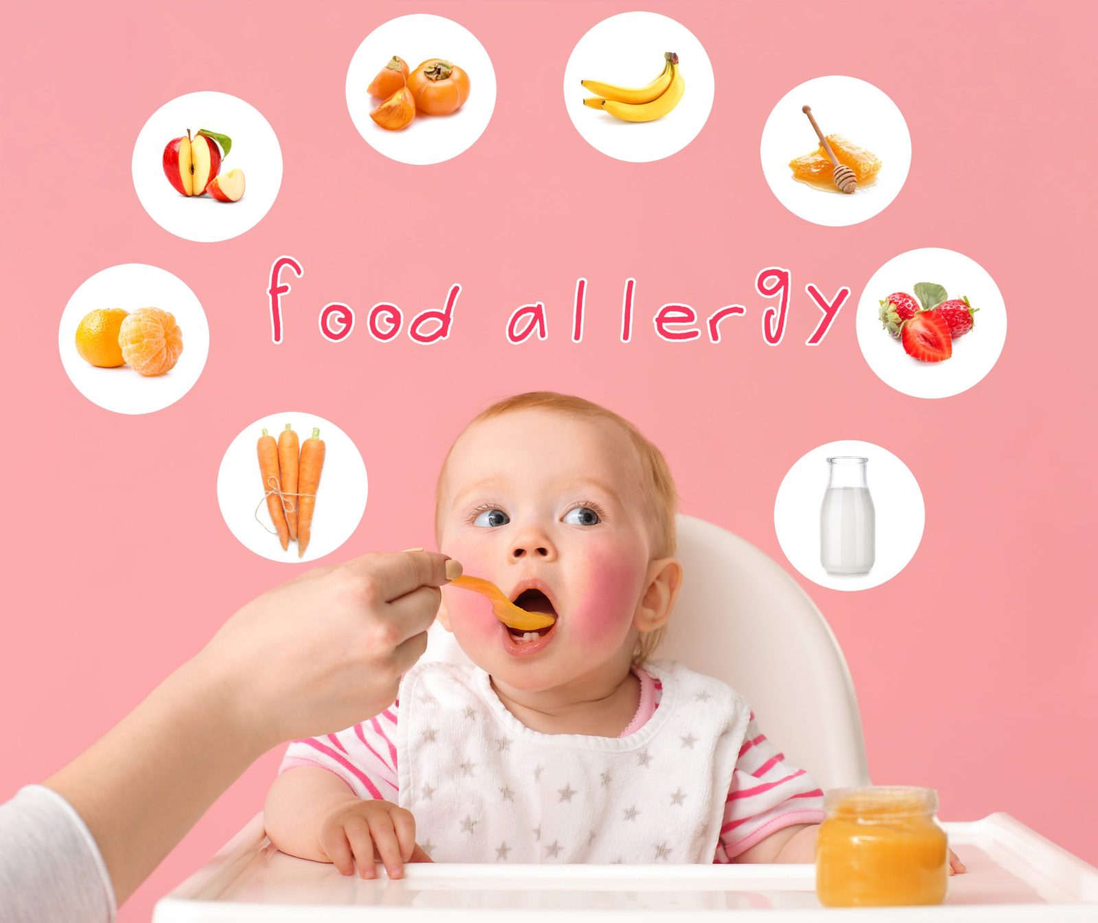 BUSTING THE MYTHS ON FOOD ALLERGIES Source Kids