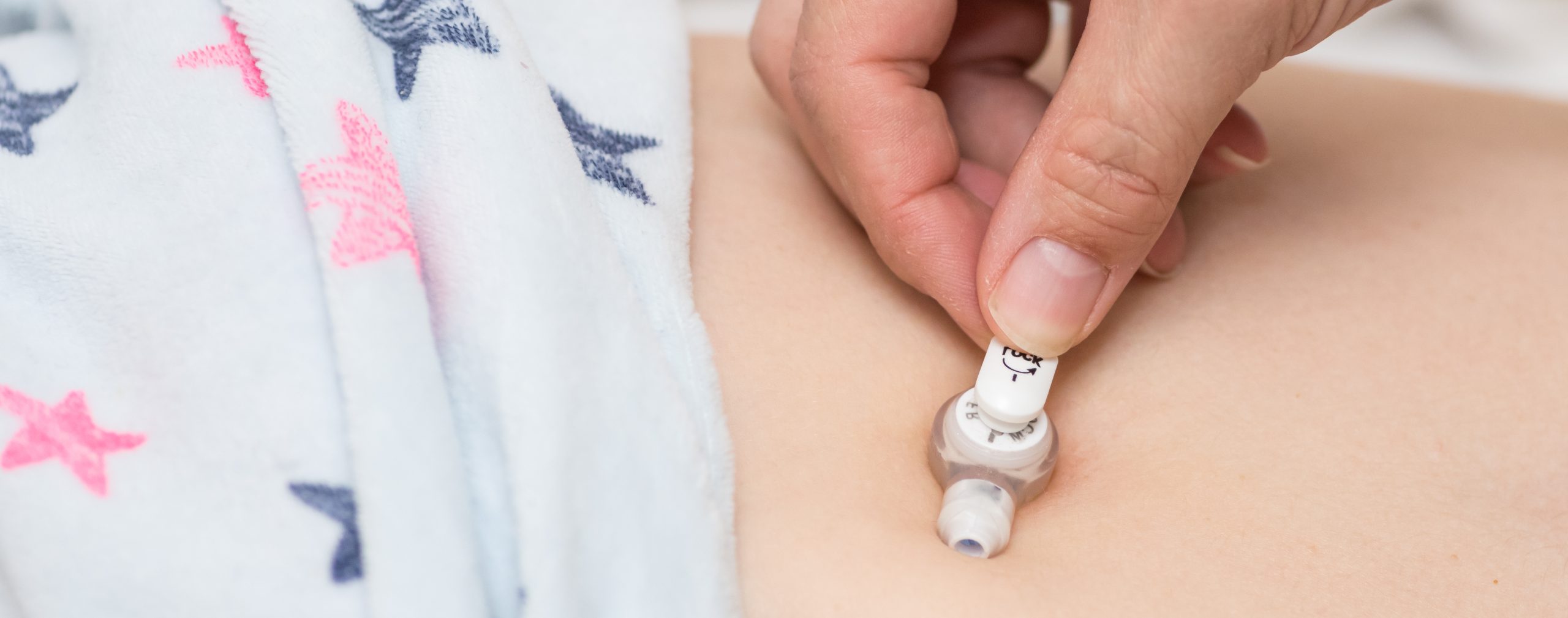 Tube feeding resources to support you and your child - Source Kids